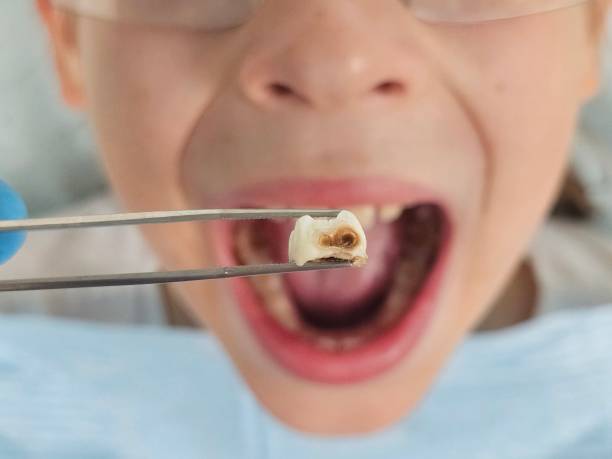 Best Emergency Tooth Extraction  in Uniontown, AL